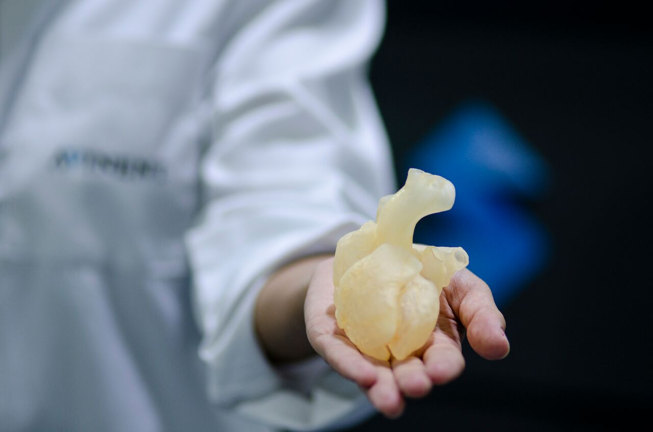 3D printed anatomical heart model
