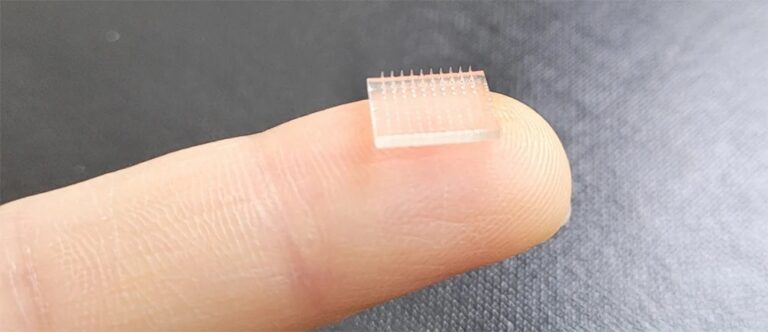 Small microneedle array shown on a fingertip