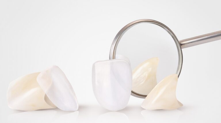 Lithium disilicate dental veneers displayed on mirrors — Lithoz