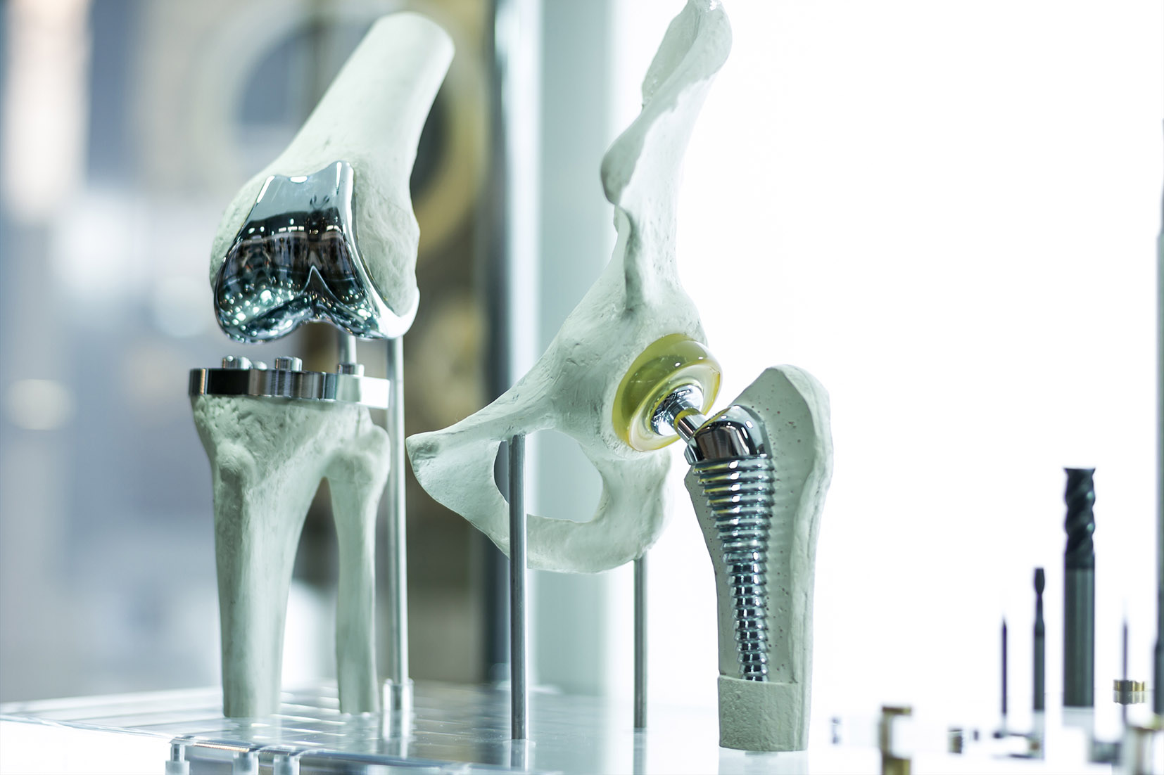 Knee and hip prostheses