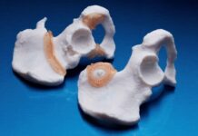 Ricoh USA, Insight Surgery, Surgical Guides, 3D Printing