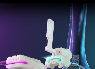 Exactech, Tibial Implants, Vantage®, Ankle Surgery