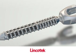 Lincotek reçoit un brevet pour une vis orthopédique imprimée en 3D