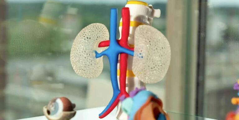 Patient-specific anatomical model of kidneys and blood vessels.