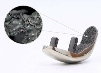 Croom Medical introduces a 3D-printed porous ingrowth technology for orthopedic implants