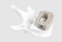 Empowering medical device manufacturers with competitive advantages to deliver the new generation of PEEK spinal implants