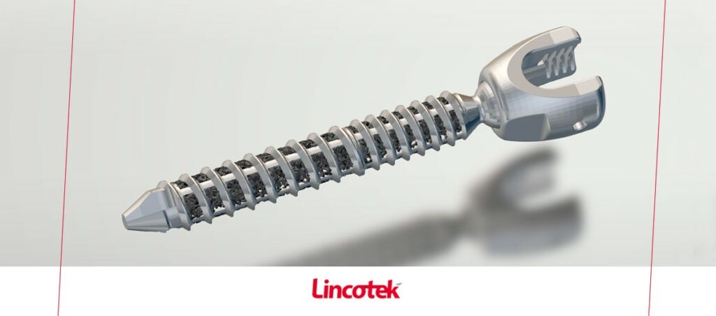 Implant rachidien imprimé en 3D