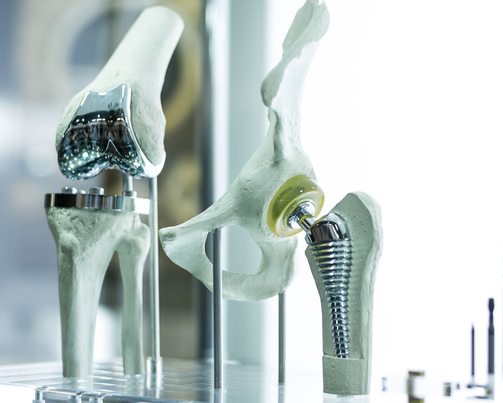 Implants orthopédiques