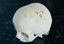 Materialise broadens CMF offering with patient-specific PEEK implants Materialise's new personalized PEEK CMF implant