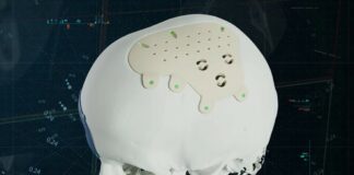 Materialise's new personalized PEEK CMF implant