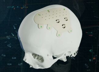 Materialise's new personalized PEEK CMF implant