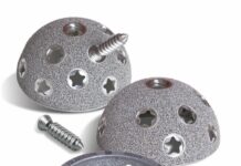 Finition de surface dans les applications d’impression 3D médicale : impact sur l’efficacité des dispositifs 3D-printed titanium hip implant. Courtesy of Smith & Nephew.