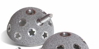 3D-printed titanium hip implant. Courtesy of Smith & Nephew.