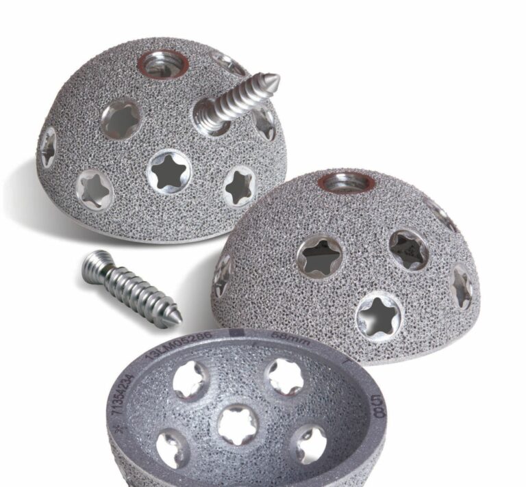 Implants de hanche en titane imprimés en 3D ; image fournie par Smith & Nephew
