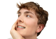 LightForce today announced the next generation in orthodontics. LightBracket Metal™.