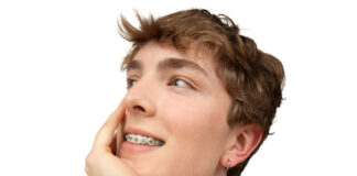 LightForce today announced the next generation in orthodontics. LightBracket Metal™.