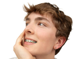 LightForce today announced the next generation in orthodontics. LightBracket Metal™.