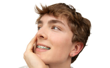 LightForce today announced the next generation in orthodontics. LightBracket Metal™.