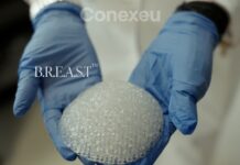 3D printed breast implant