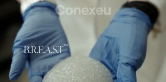 3D printed breast implant