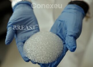 3D printed breast implant