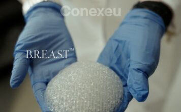 3D printed breast implant