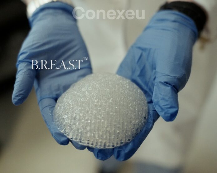 3D printed breast implant