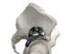 3D printed hip implant