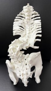 Anatomical Model for Spine Scoliosis - Back