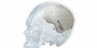 FDA clearance paves the way for Walter Reed to deploy 3D‑printed titanium cranial implants in patient care
