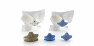 KLS Martin_Zygomatic Onlay Implant_made from Hydroxyapatite_Green Part_Sintere