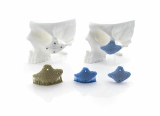 IPS Gate® integration drives KLS Martin’s delivery of 500 LCM printed bioceramic implants KLS Martin_Zygomatic Onlay Implant_made from Hydroxyapatite_Green Part_Sintere