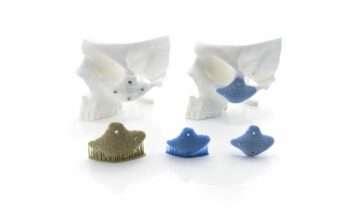 KLS Martin_Zygomatic Onlay Implant_made from Hydroxyapatite_Green Part_Sintere