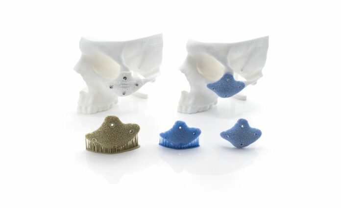 KLS Martin_Zygomatic Onlay Implant_made from Hydroxyapatite_Green Part_Sintere KLS Martin_Zygomatic Onlay Implant_made from Hydroxyapatite_Green Part_Sintere