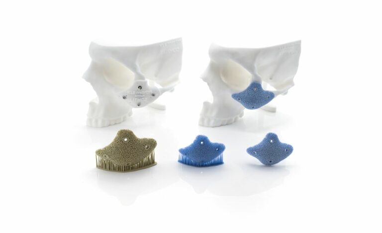 Craniofacial models and blue and beige bioceramic implants.